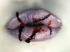 bléssures...